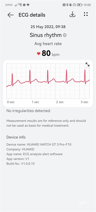 Huawei Watch GT 3 Pro Review 31