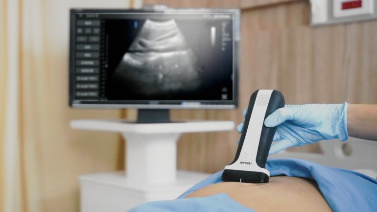 ASUS Portable Ultrasound Solution Healthcare solutions Computex 2023