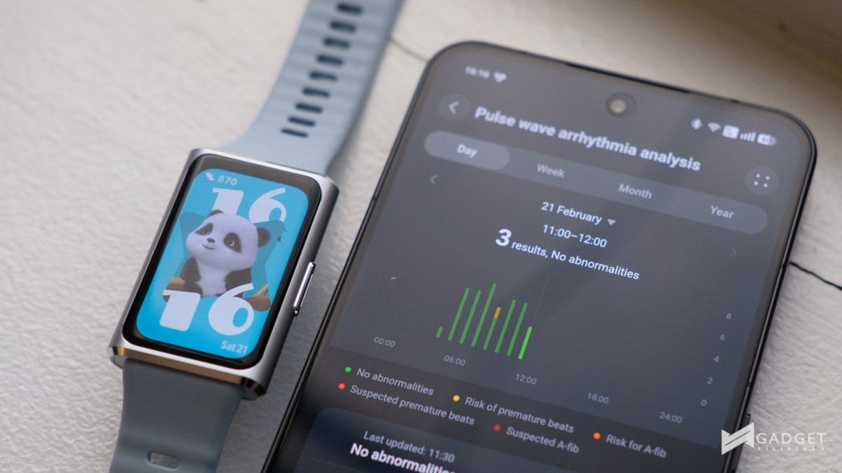 HUAWEI Band 11 Pro Review Pulse Wave Arrhythmia